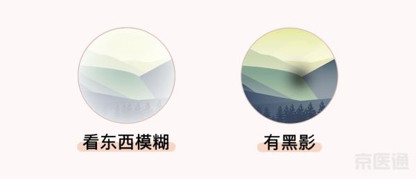 同仁醫(yī)生:4個(gè)眼科測(cè)試圖,1分鐘測(cè)眼睛是否健康,！