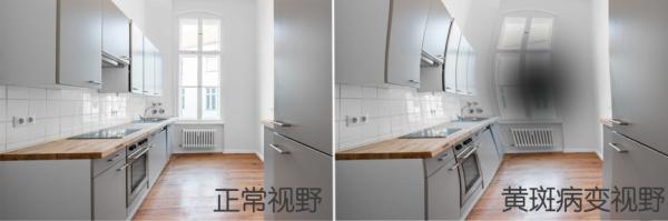 同仁醫(yī)生:4個(gè)眼科測(cè)試圖,1分鐘測(cè)眼睛是否健康,！