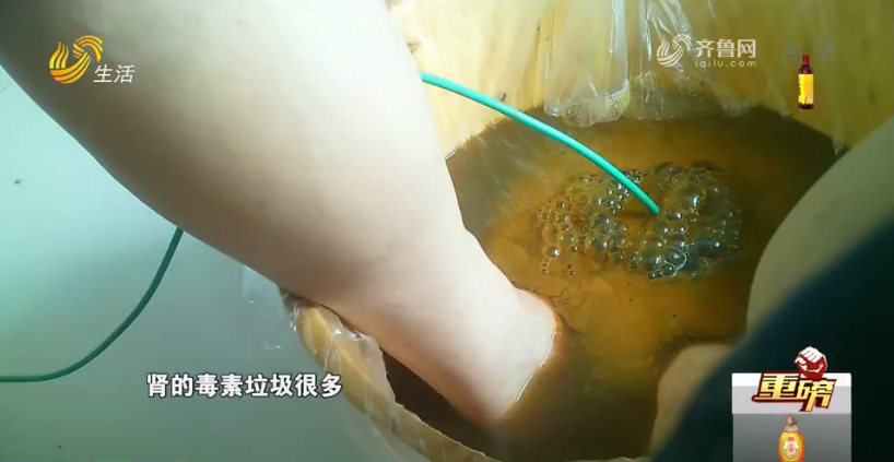 一個(gè)泡腳盆能治百?。∮浾叩降牦w驗(yàn)，當(dāng)場被“診”出11種病……