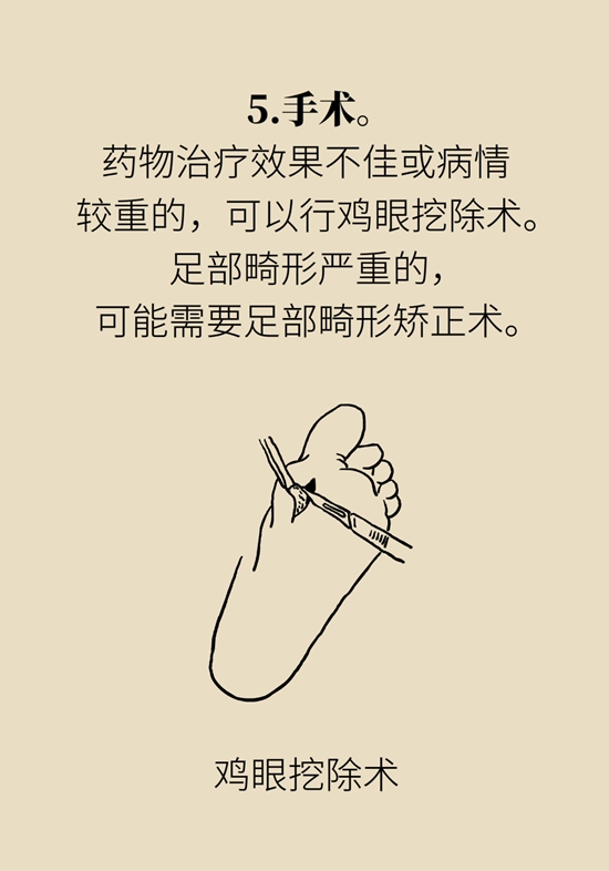 長了雞眼和老繭怎么辦,？這份防治指南請收好
