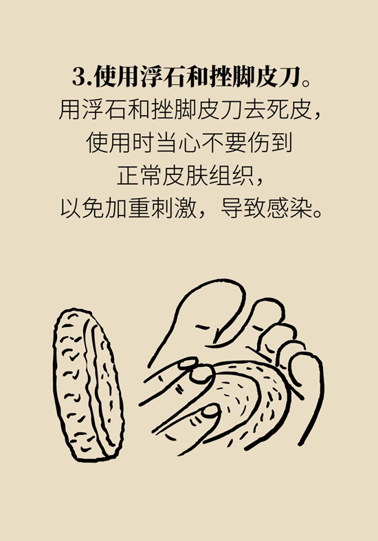 長了雞眼和老繭怎么辦,？這份防治指南請收好