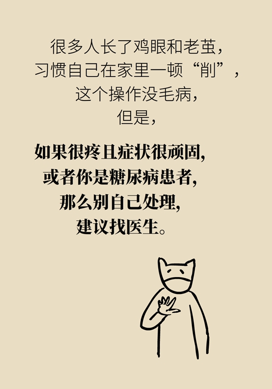 長了雞眼和老繭怎么辦,？這份防治指南請收好