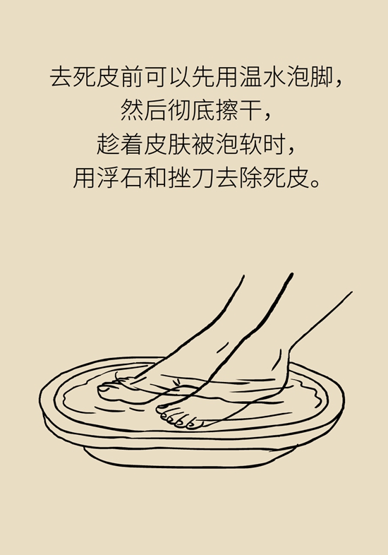 長了雞眼和老繭怎么辦,？這份防治指南請收好
