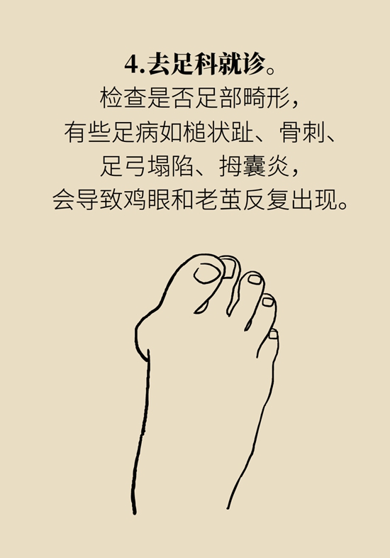 長了雞眼和老繭怎么辦,？這份防治指南請收好