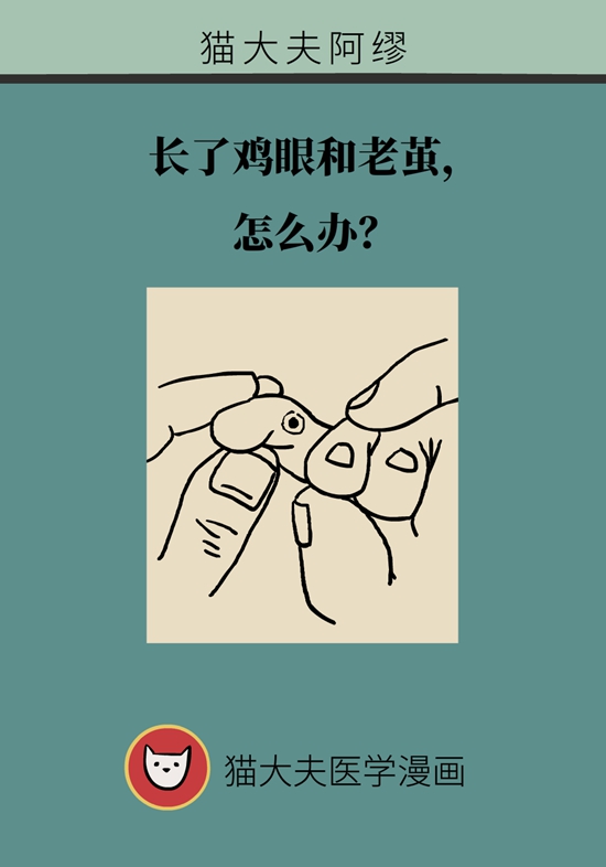 長了雞眼和老繭怎么辦,？這份防治指南請收好
