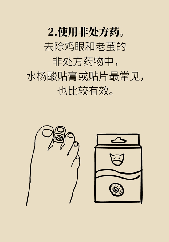 長了雞眼和老繭怎么辦？這份防治指南請收好