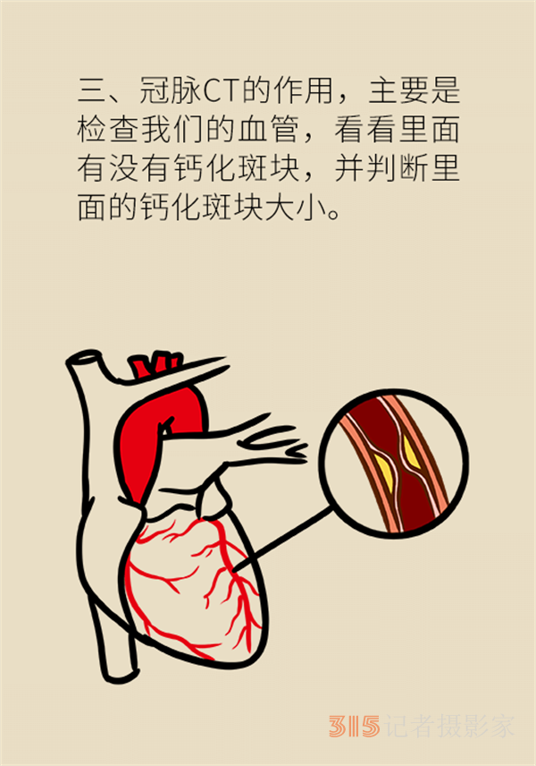 老人心血管疾病高發(fā)，這些常用檢查方法務(wù)必了解
