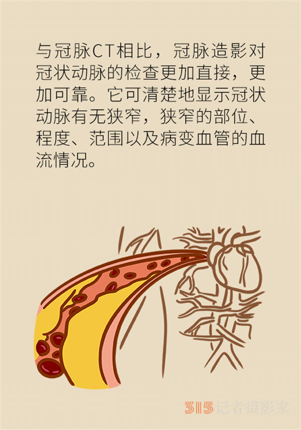 老人心血管疾病高發(fā),，這些常用檢查方法務(wù)必了解