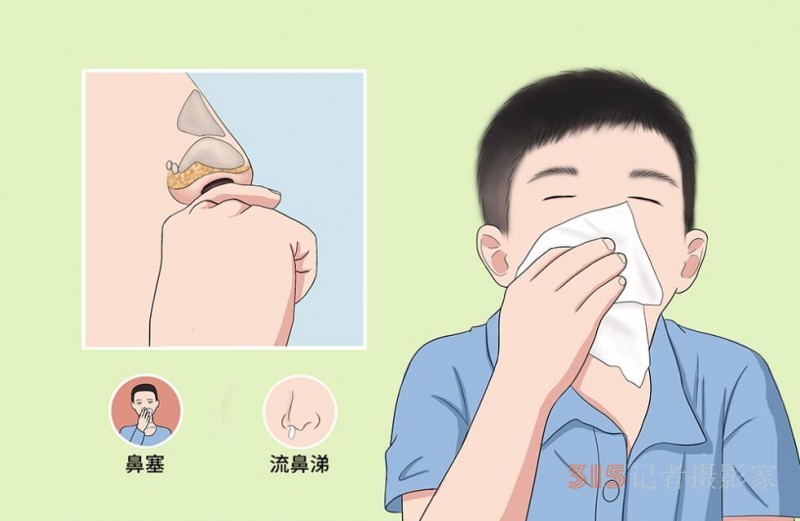 打噴嚏、流鼻涕,、鼻塞,、呼吸困難、眼睛腫,、耳朵癢——原來還有這樣出奇的療愈方法
