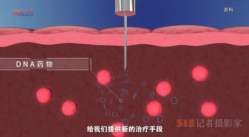 宮頸癌消滅戰(zhàn):如何減少“梅艷芳式悲劇”,? 宮頸癌消滅戰(zhàn):如何減少“梅艷芳式悲劇”,?